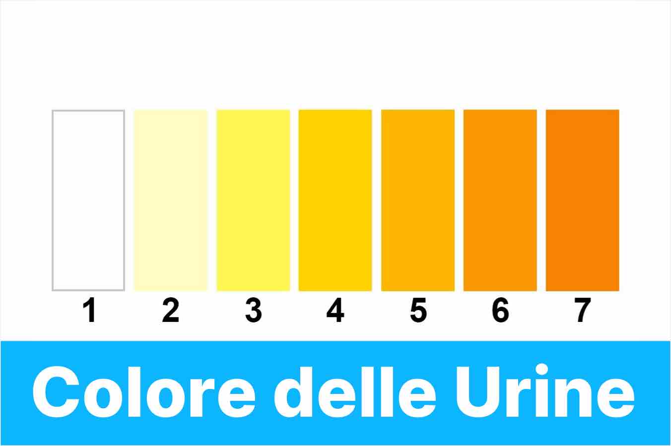 Urine Scure E Maleodoranti Al Mattino